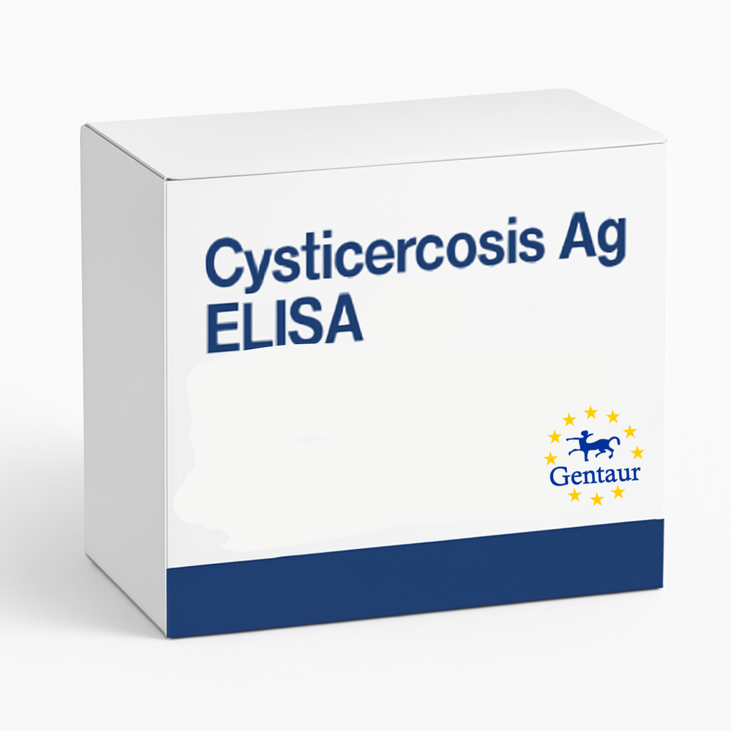 Cysticercosis Antigen ELISA Kit